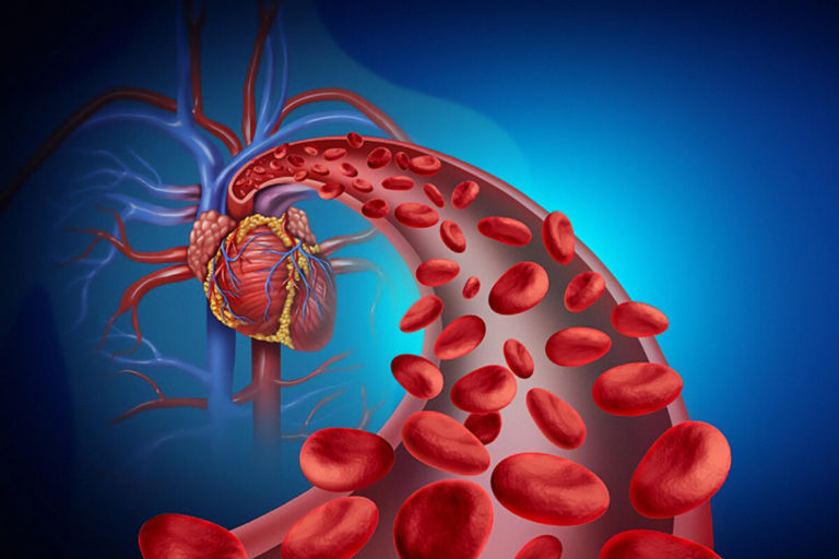 Präparative Apherese & therapeutische Apherese